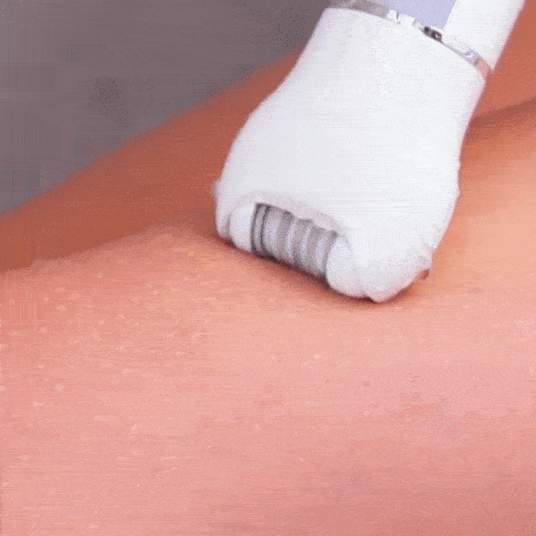 🔥 Vaša Koža Može Izgledati Savršeno – Svaki Dan!